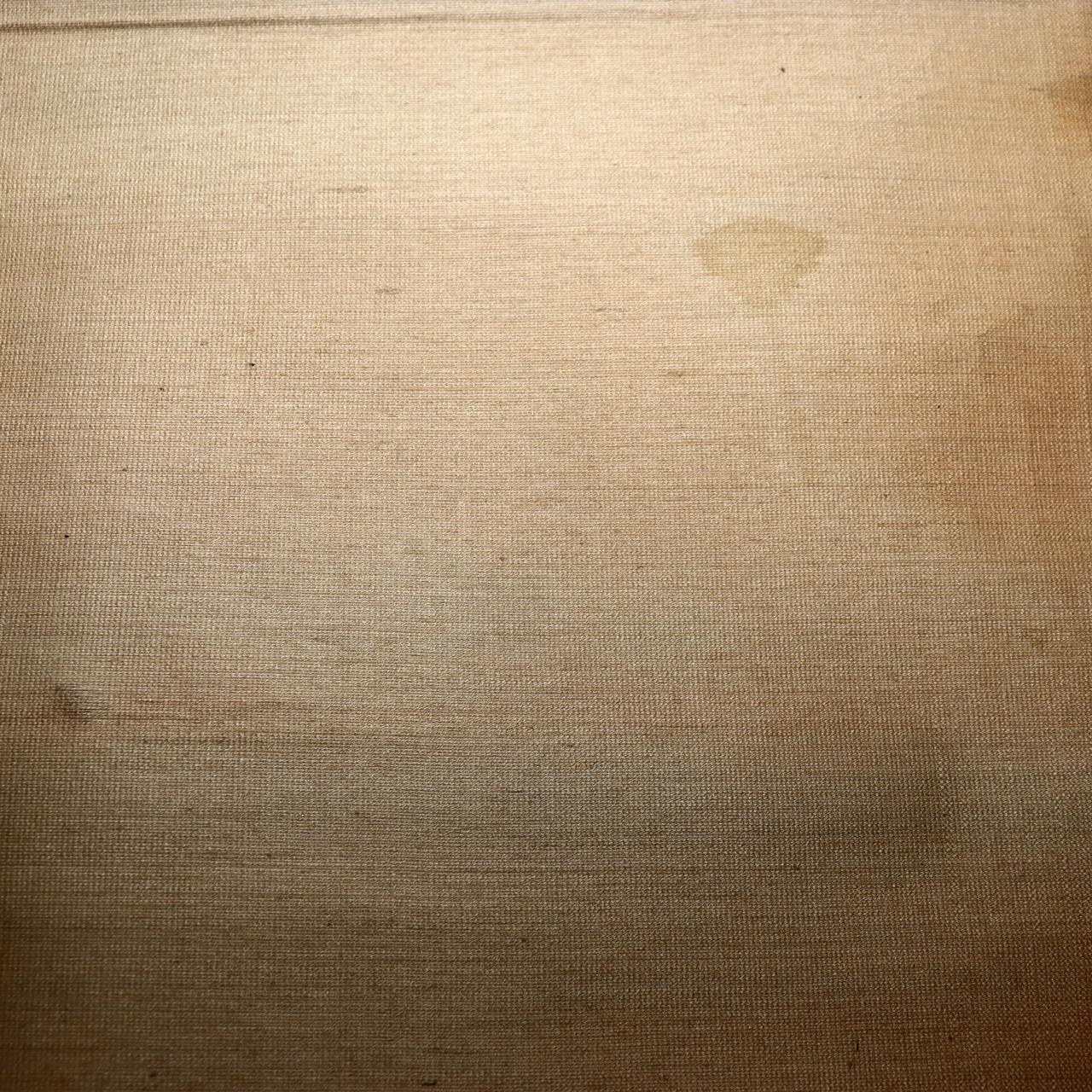 45157123